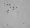  Bal con linfocitosis. Dic Quick. 40x.
