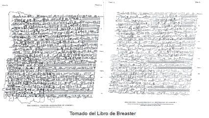 Libro de Breaster