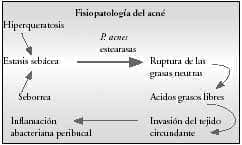 Fisiopatología del Acné