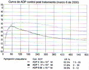 Curva de ADP control post tratamiento Curva de ADP control post tratamiento