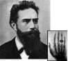 Roentgen