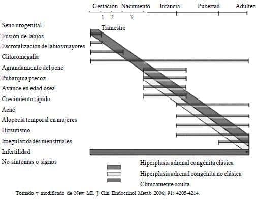 Deficiencia de 21 hidroxilasa