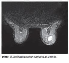 Resonancia nuclear magnética