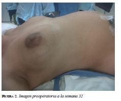 Imagenpreoperatoria