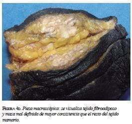 Pieza macroscópica