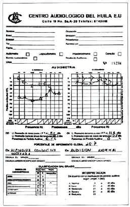 Audiometría