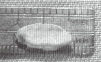 Medición del injerto compuesto de concha auricular