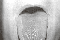 Lengua seca despulida