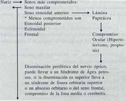 Compromiso intraorbitario y cerebral