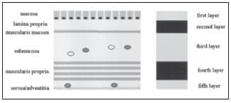 Observan Cinco Capas de la Pared del Estómago Ecoendoscopia Radial