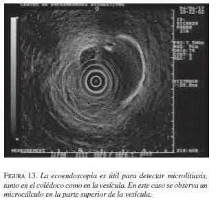 La Ecoendoscopia es útil
