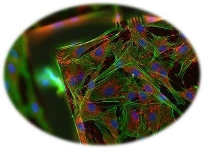 Fibroblastos