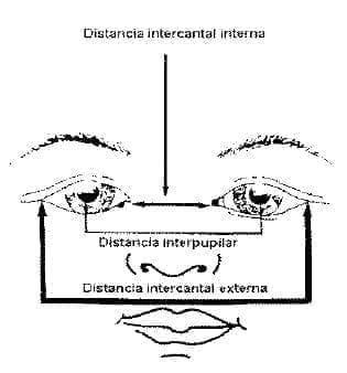 Distancia intercantal interna Distancia intercantal interna