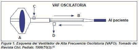 Esquema del Ventilador de Alta Frecuencia Esquema del Ventilador de Alta Frecuencia