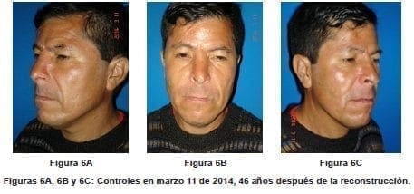 Estado Actual después de 46 años Estado Actual después de 46 años