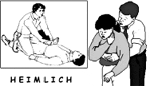 Maniobra de Heimlich Maniobra de Heimlich