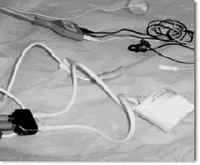 Brazalete Neonatal 