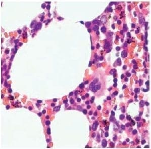 Componente hematopoyético