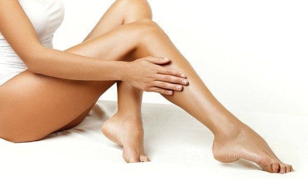 varices