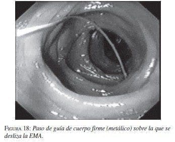 Paso de guía de cuerpo firme (metálico) sobre la que se desliza la EMA.