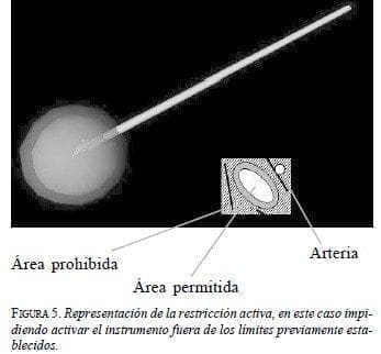 Sistema da Vinci: Representación de la restricción activa