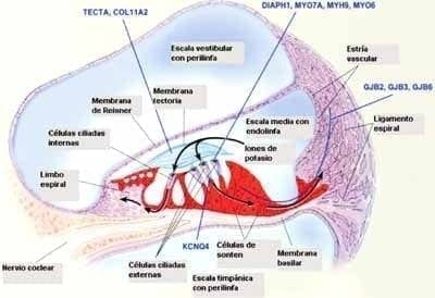 Distribución coclear en sordera