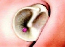 Tipos de perforaciones