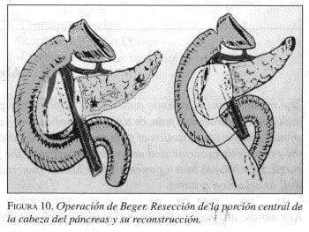 Operación de Beger