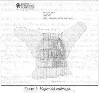 Mapeo del estómago