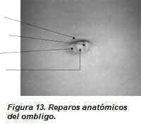 Reparos Anatómicos del Ombligo Reparos Anatómicos del Ombligo