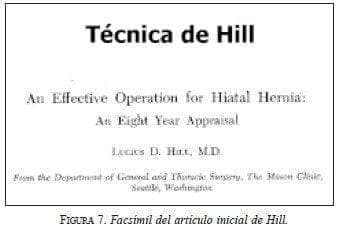 Facsímil del artículo inicial de Hill