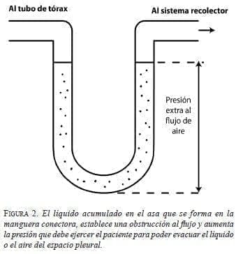 El líquido acumulado en el Asa que se forma en la Manguera Conectora El líquido acumulado en el Asa que se forma en la Manguera Conectora