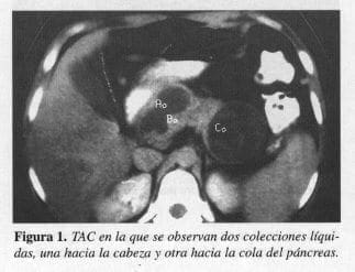 Dos Colecciones Líquidas Dos Colecciones Líquidas
