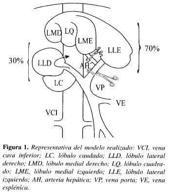 Isquemia Normotérmica, vena cava inferior Isquemia Normotérmica, vena cava inferior