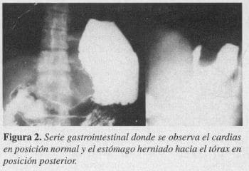 Serie Gastrointestinal