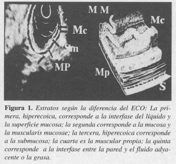 Endosonografía, Estratos según la diferencia del ECO