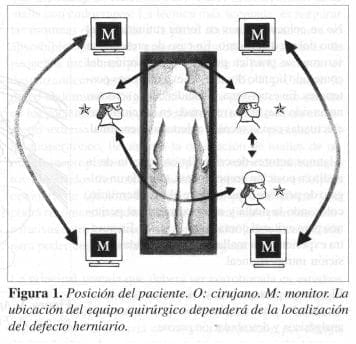 Hernia Incisional, Posición del paciente