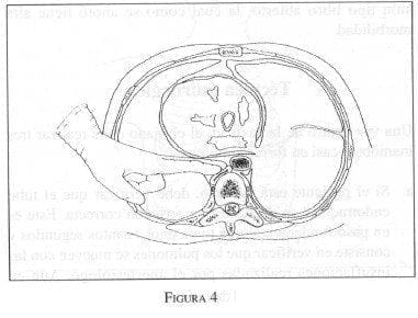 Clamp es mucho más fácil la Oclusión manual de la Aorta
