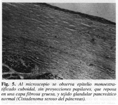 Epitelio Monoestratificado Cuboidal
