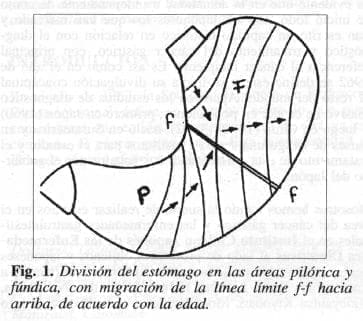 División del Estómago División del Estómago