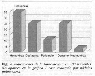 Indicaciones de la toracoscopia