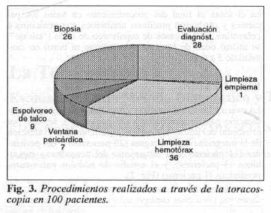 Procedimientos Realizados a través de la Toracoscopia