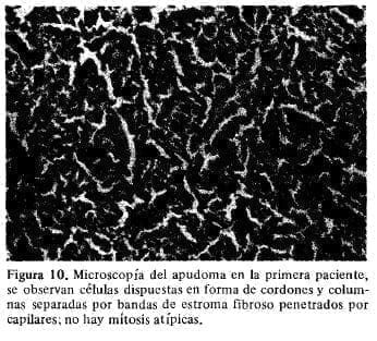Microscopía del Apudoma en la primera Paciente