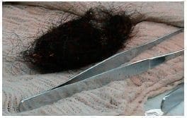 Bola de pelo