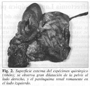 Parénquima renal