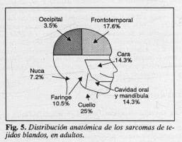 Sarcomas de tejidos blandos