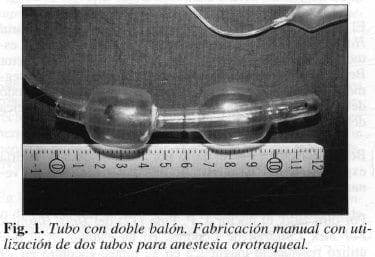 Tubo con doble balón