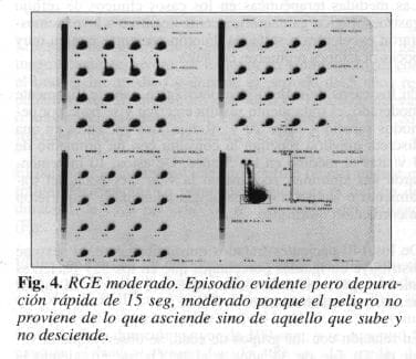 RGE moderado