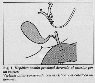 Vesícula biliar conservada con el cístico