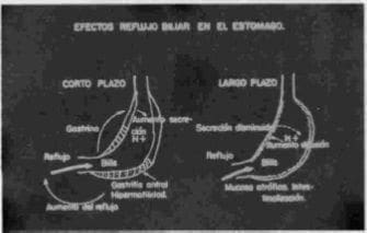 Efectos de la bilis